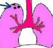 Ogniskowa gruźlica płuc