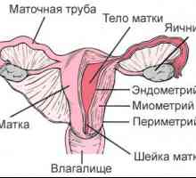 Gruczolistość (endometrioza, trzonu macicy)