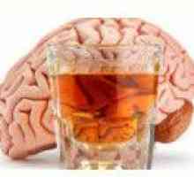 Encefalopatia alkoholikiem