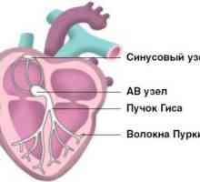 Arytmia serca