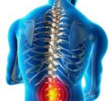 Ból pleców: przyczyny, leczenie