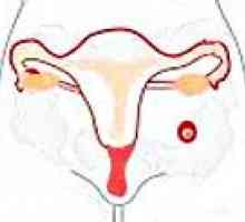 Ciąża brzuszna