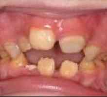 Wady dentystyczne