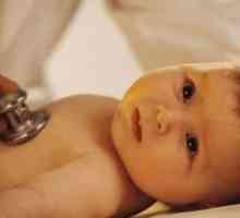 Deformacja pęcherzyka żółciowego u dziecka