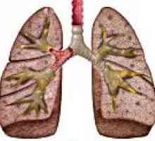 Przewlekłe zapalenie płuc