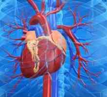 Przewlekła niewydolność serca: objawy, leczenie