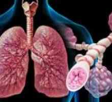 Przewlekłe choroby płuc, nieswoiste