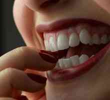 Zęby korekcyjny (okluzji) bez nawiasów