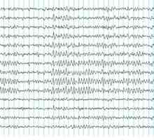 Elektroencefalografii (EEG)