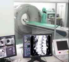 Tomografii komputerowej (CT tomografia), X-Ray
