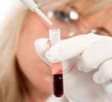 Leukocytów we krwi w czasie ciąży