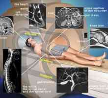 Obrazowanie metodą rezonansu magnetycznego (MRI). Wskazania, przeciwwskazania, MRI