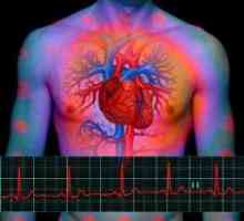 Myocardiodystrophy (dystrofię mięśnia sercowego)
