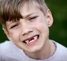 Zęby mleczne u dzieci i ich zmiany