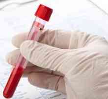 Niski poziom hemoglobiny (anemia)