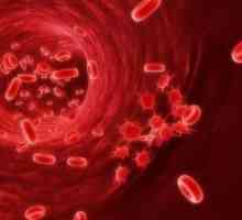 Zmniejszenie liczby płytek krwi: przyczyny, objawy, leczenie