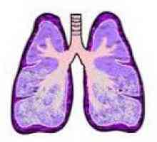 Obrzęk płuc