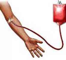 Powikłania po transfuzji