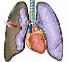 Uszkodzenie płuc