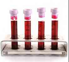 Podwyższona szybkość sedymentacji erytrocytów we krwi
