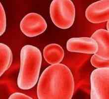 Podwyższone stężenia hemoglobiny we krwi