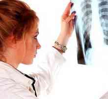 Objawy raka płuca we wczesnym stadium