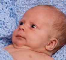Ciśnienie śródczaszkowe u noworodków