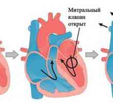 Wypadnięcie zastawki mitralnej serca