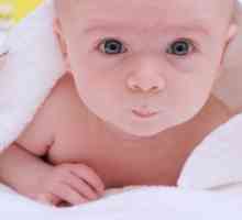 Łuszczenie skóry u noworodków