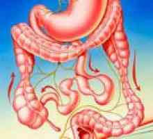 Zespół nadwrażliwości jelita grubego (IBS)