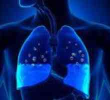 Toksyczny obrzęk płuc