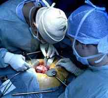 Transplantacji nerek (nerki)