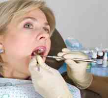 Usuwanie kamienia stomatologicznego ultradźwiękami
