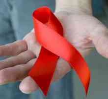 Zakażenie HIV i AIDS