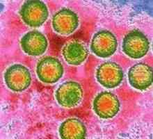 Wirus Epsteina-Barra (EBV lub infekcji zakażenie EBV)