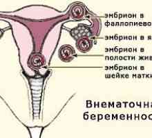 Ciąża pozamaciczna