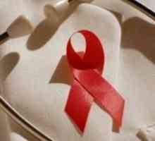 Kobiety są szczególnie narażone na ryzyko zakażenia wirusem HIV