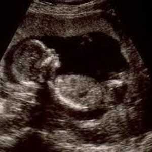 Badanie położnicze w czasie ciąży