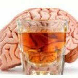 Encefalopatia alkoholikiem