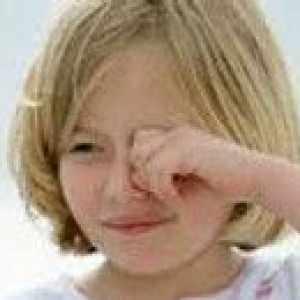 Alergiczne zapalenie spojówek u dzieci