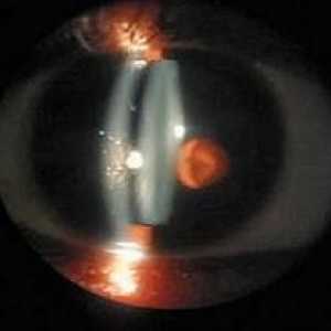 Biomicroscopy oczy