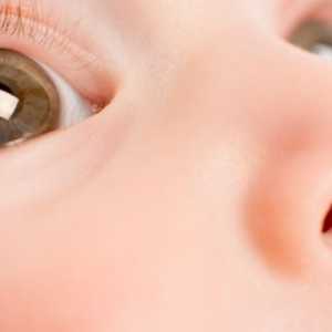 Infekcje oczu u dzieci