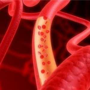 Jak wzmocnić serce i naczynia krwionośne ludowych środki zaradcze?