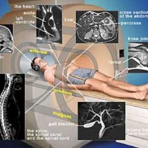 Obrazowanie metodą rezonansu magnetycznego (MRI). Wskazania, przeciwwskazania, MRI