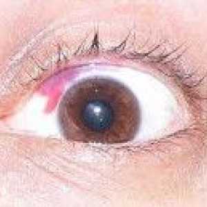 Mechaniczne uszkodzenie oczu