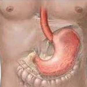 Ostre zapalenie błony śluzowej żołądka