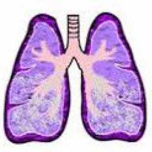 Obrzęk płuc