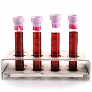 Podwyższona szybkość sedymentacji erytrocytów we krwi