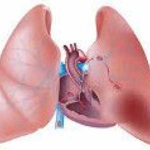 Niewydolności sercowo-płucnej