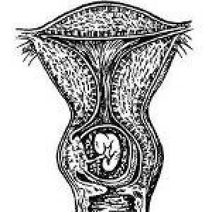 Ciąża szyjki macicy